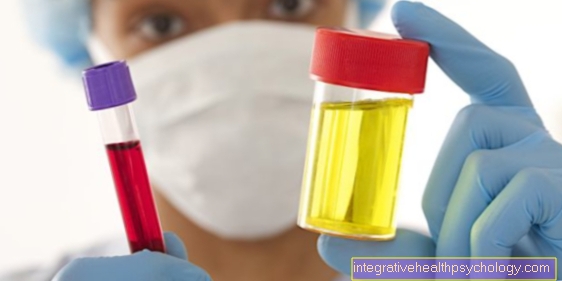 kaalulangus vere uriini sumptomites parimate tervislike kaalulanguse raputab
